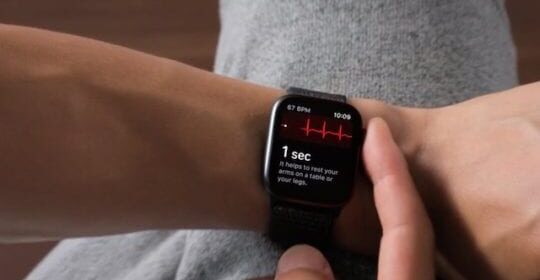 Cosa aspettarsi da Apple Watch Serie 5